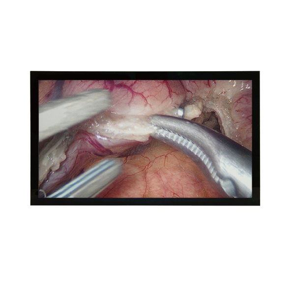 BDS Medical Monitor Series