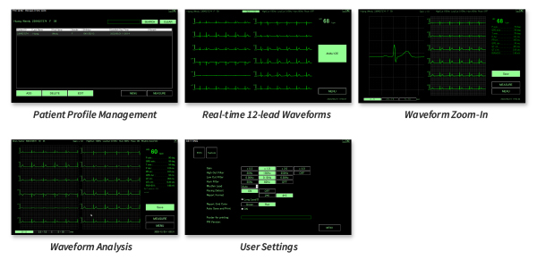 User friendly BriteMED 12-lead portable ECG