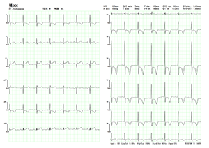 BriteMED 12-Lead Portable ECG