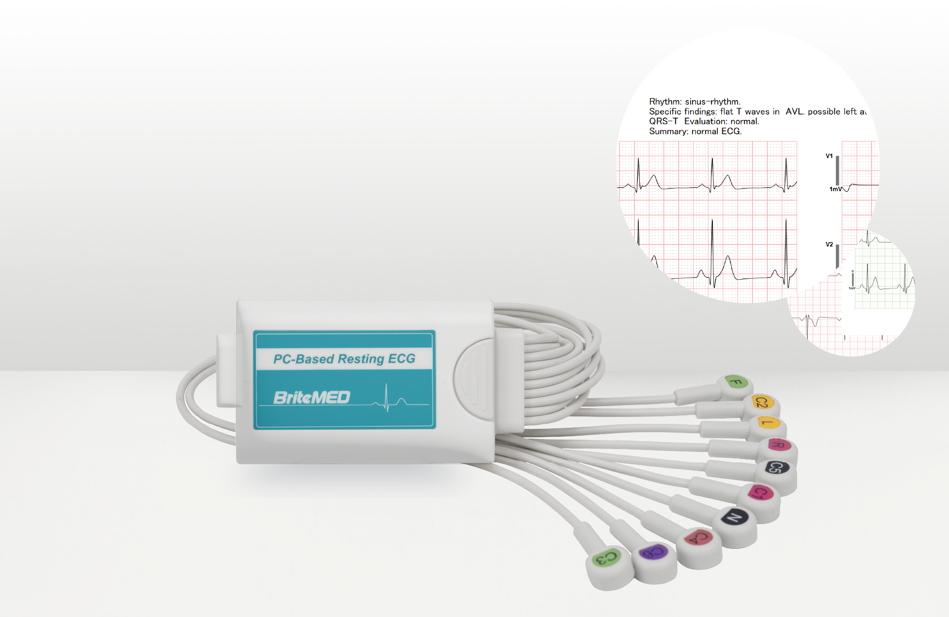 Wireless 12-Lead Portable ECG Device